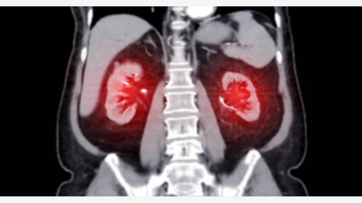 A contrast-enhanced CT scan of the abdomen — the imaging modality Alibaba's RADAR model reads to report 146 distinct clinical findings.